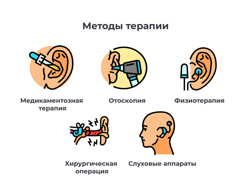 Почему возникает шум в ушах — виды и лечение | Блог | Complimed