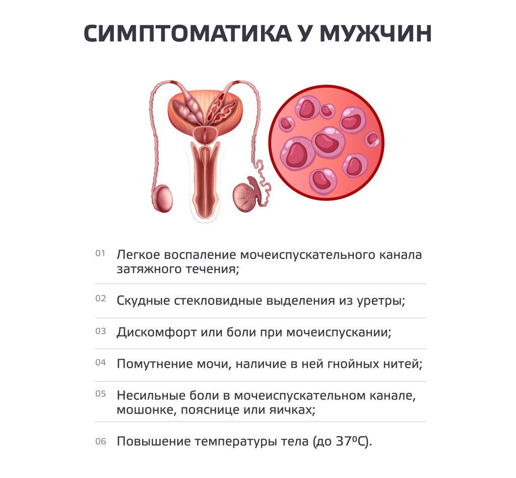 Хламидиоз — что это, причины, симптомы, лечение | Блог | Complimed